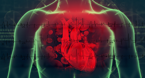 La Myocardite Fulminante Cardiologie Pratique